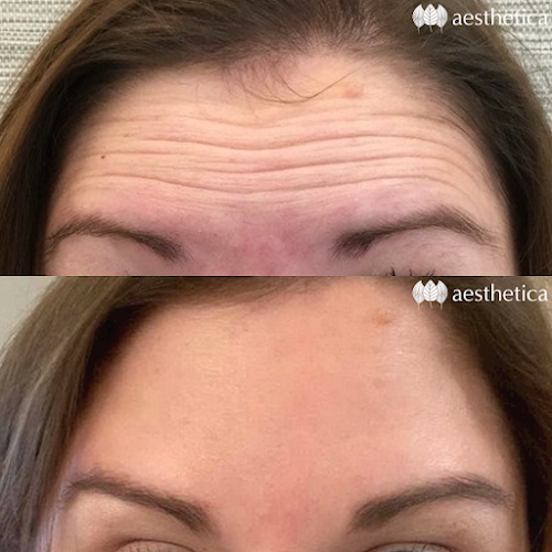 Aesthetica Medical Spa