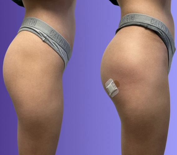 Laser Skin & Wellness Center