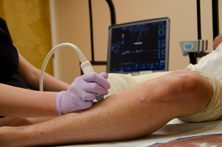 Advanced Vein Center