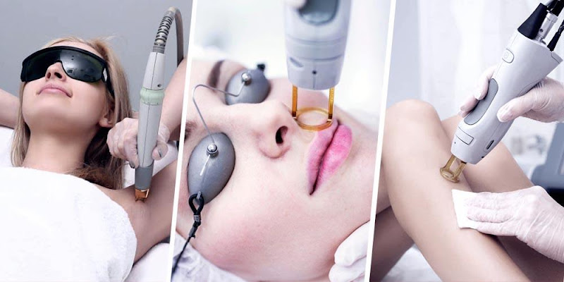 LASER LUXURY OF SUMMERVILLE