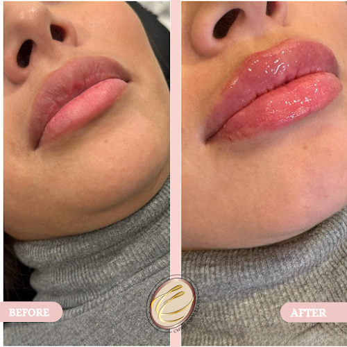 Creole Contour Aesthetics