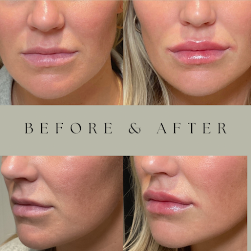 Louisville Aesthetics