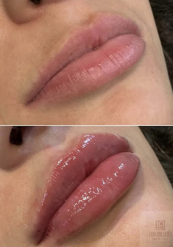 LA Lash and Laser Med Spa