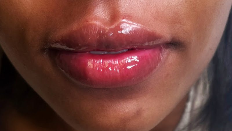 S&N Aesthetics| Med Spa