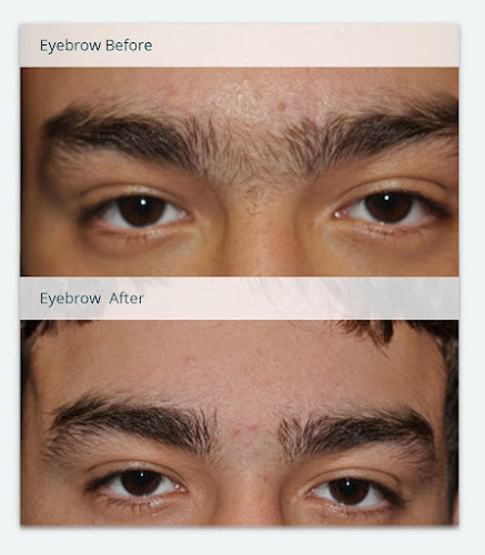 Turning Point Laser Clinic