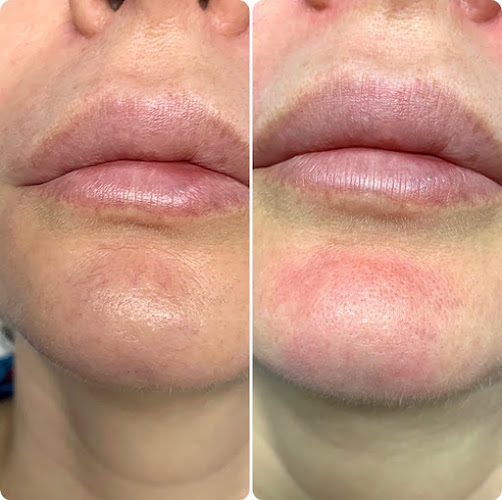 GetSkin Medical Spa & Wellness