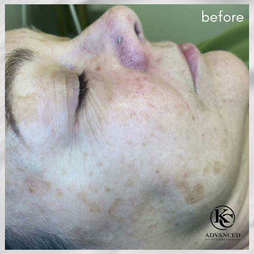 Kim Clark Advanced Aesthetics