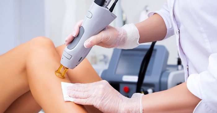 Laser hair removal Philadelphia