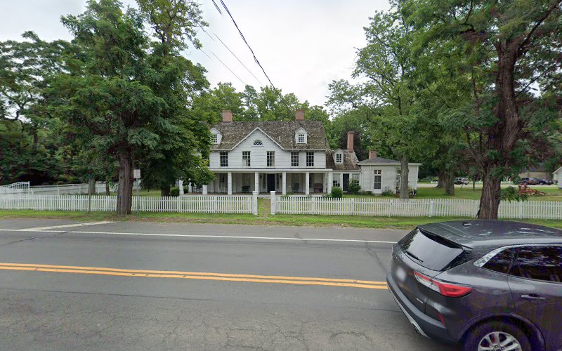 LMDJ laser haïr removal