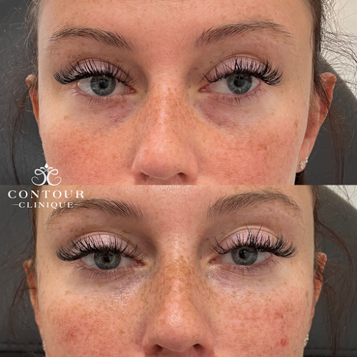 Contour Clinique Med Spa