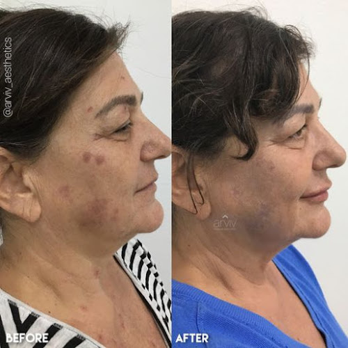 Arviv Medical Aesthetics Tampa