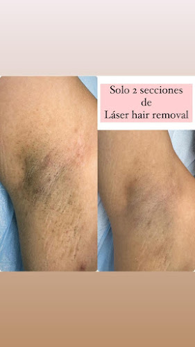 Perfect Body By Yuly