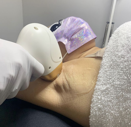 Laser Hair Removal Brickell Salon & SPA