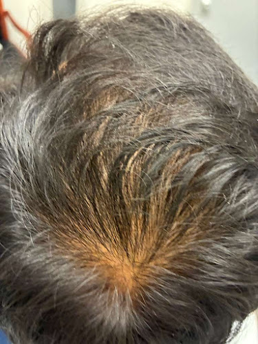 Rani V. Ramachandran M.D - Skin Care Clinic in San Jose