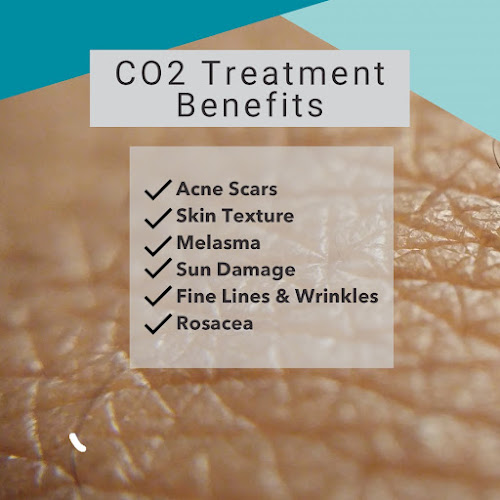 Aspire Medical Spa Arvada | Botox, Filler & Lasers