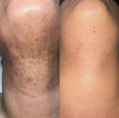 Touch Advanced Aesthetics