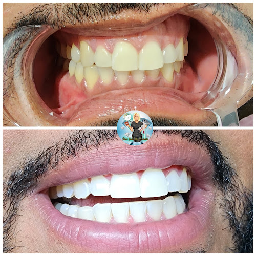 Glow Smile by Michelle