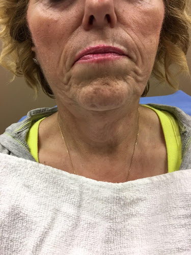 Luxuria Medical Spa & Laser Center Laser Tattoo Removal