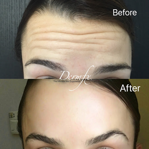 DermFx Redondo Beach