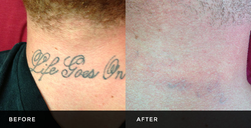 Tri-County Laser Center