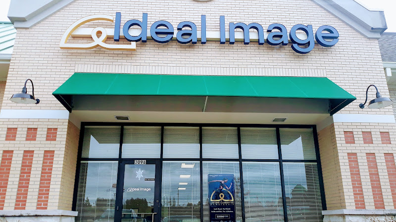 Ideal Image O'Fallon