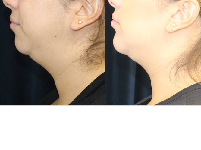 Nazarian Plastic Surgery - Dr. Sheila Nazarian