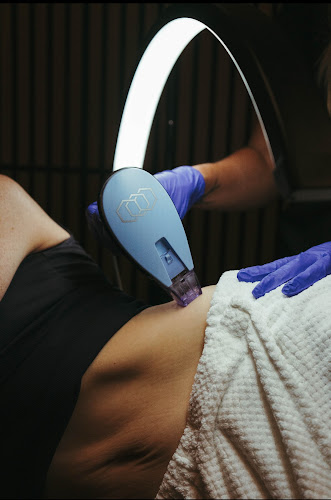 Hush Lasers and Aesthetics