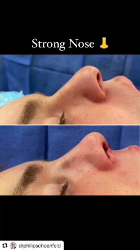 RENU by Dr. Philip S Schoenfeld (Plastic Surgeon)