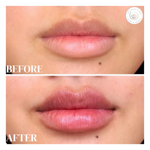 Advanced Laser Clinic And MedSpa