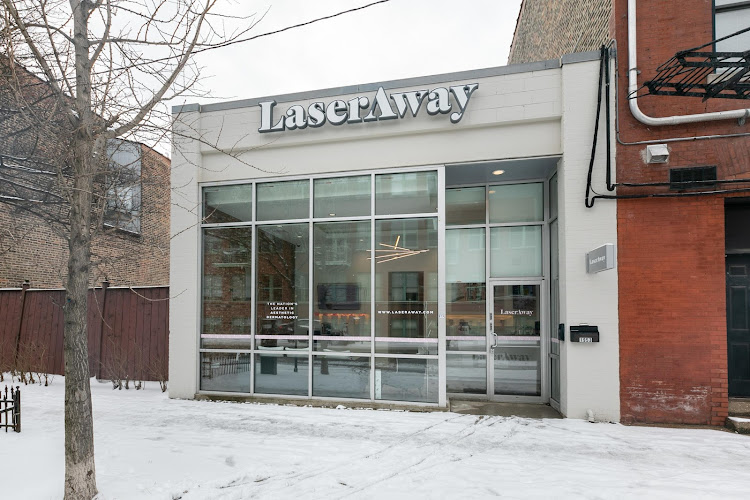 LaserAway - Bucktown