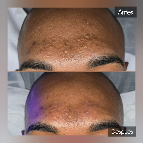 Natural Beauty Skin Care