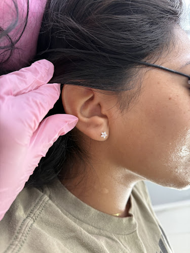 Bliss Laser Aesthetics