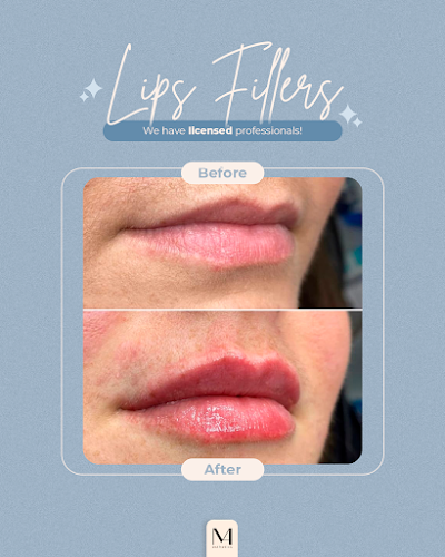 Aesthetics Clinic in Milford - M.A Esthetics (Wax, hair removal laser, Ultramed, Post op, Elletrobody) Estética em Milford