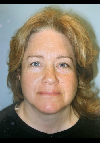 ADIRONDACK LASER & Skin Esthetics