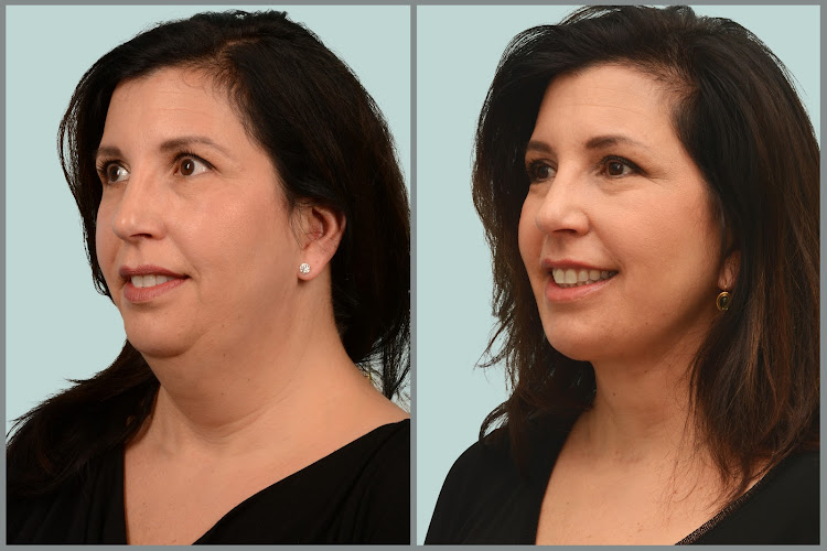 Ditesheim Cosmetic Surgery