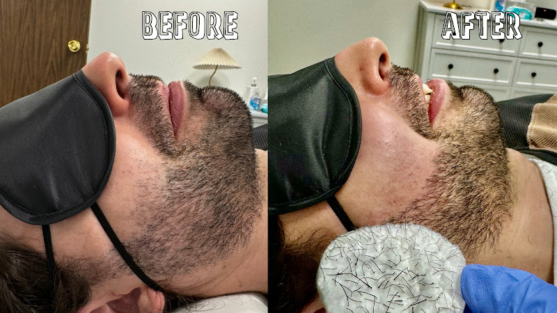 Electrolysis Hair Removal Lab