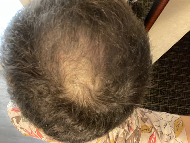 Washington Medical Hair Clinics