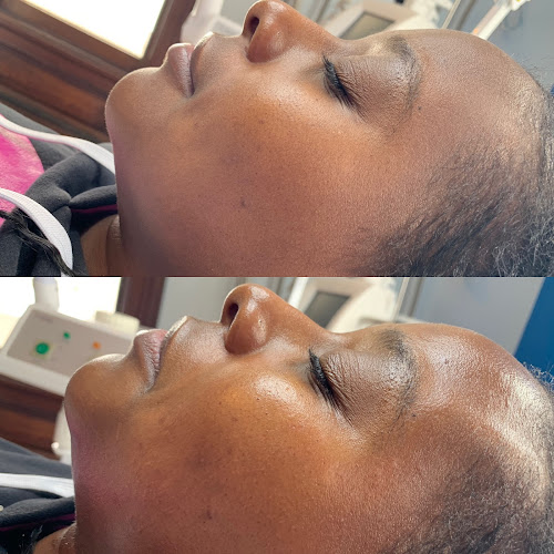 A Fine Line Aesthetics