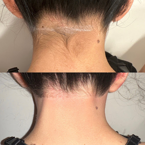 Austin Laser Solutions - Sunset Valley