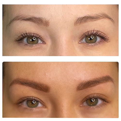 New Age Laser and Aesthetics