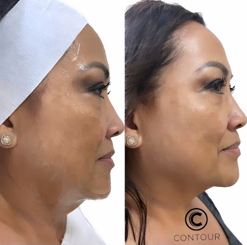 Contour Medical Spa