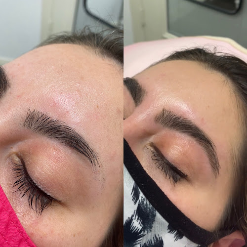 Skin Things - Brazilian/Bikini Waxing, Sugaring & Laser Hair Removal in Frisco, Texas