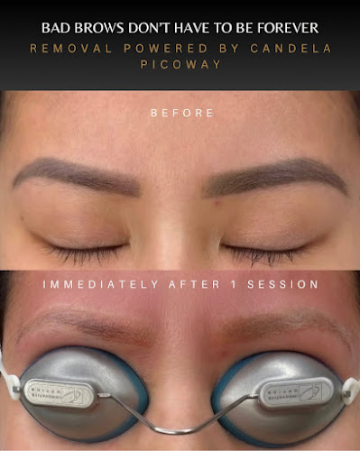 DMV Laser Beauty Clinic | Best Laser Hair Removal | PicoWay Brows, Lip Blushing & Body Tattoo Removal & Rejuvenation