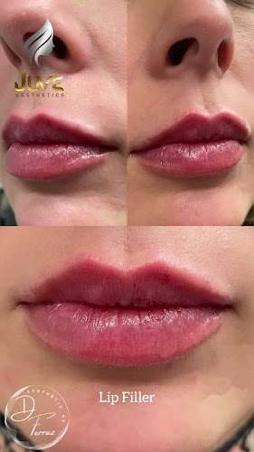 Juves Aesthetics & Cosmetic Procedures