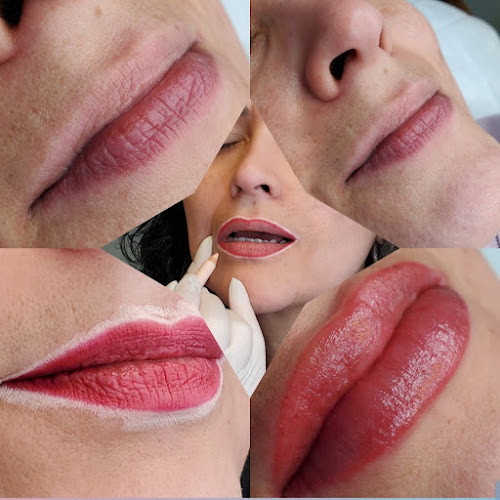 Facesthetix Boca Raton