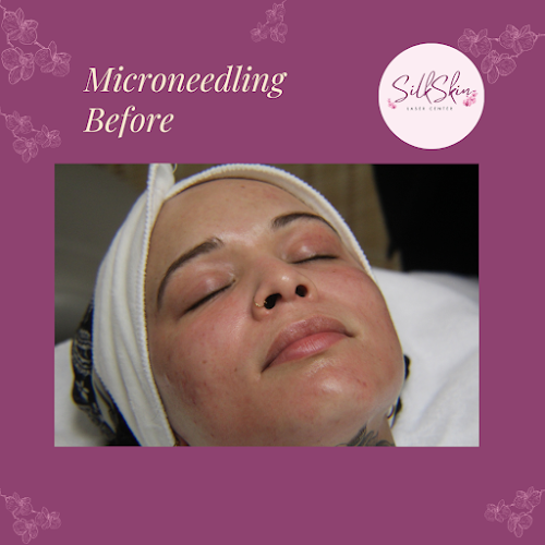 Silk Skin Laser Center