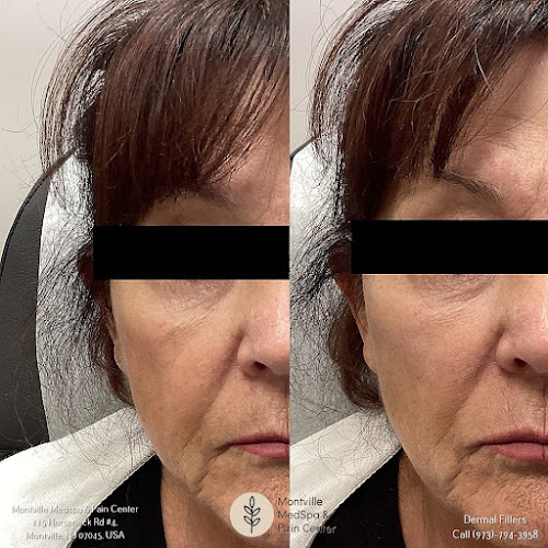 Montville Medspa & Pain Center: Donna D'Alessio, MD