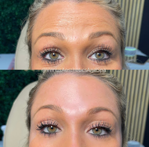 Venus Aesthetics Miami