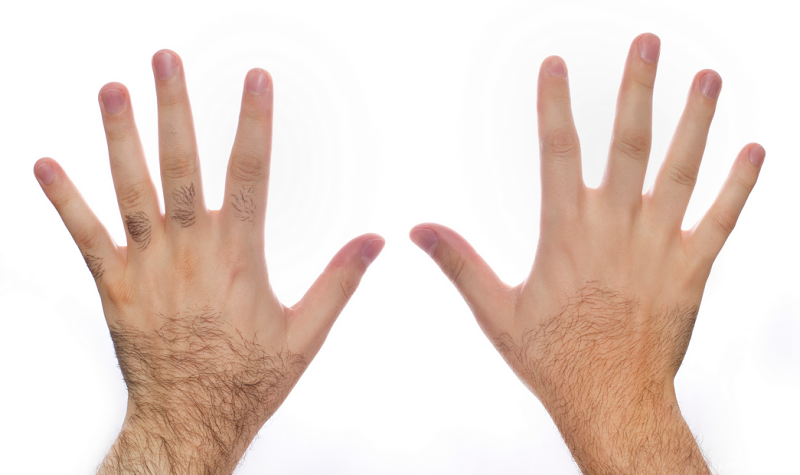 Nolan's Electrolysis LLC