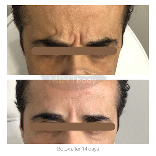 MINTbody Med Spa & Wellness Fairfield